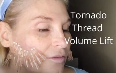 Tornado Thread for Volume Lift