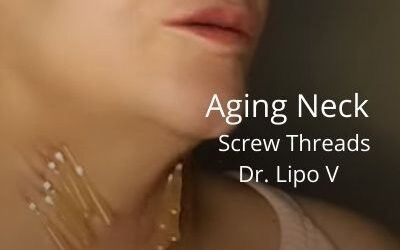 Aging Neck | Dr. Lipo V – Fat Dissolver and Screw Threads | Acecosm.com