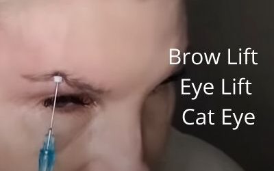Brow Lift | Eye Lift | Cat Eye | Get Glowing Now Skin Care