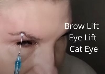 Brow Lift | Eye Lift | Cat Eye | Get Glowing Now Skin Care