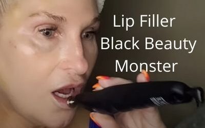 Lip Filler | Black Beauty Monster  | Getglowingnowskincare.com