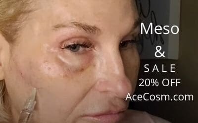 Meso |  20% off Sale – Acecosm.com