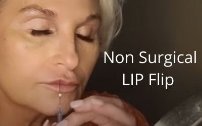 Non Surgical LIP Flip | D23 Cog Threads |Acecosm.com | How to Stop a Disaster