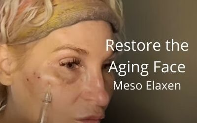 Restore the Aging Face – Meso Elaxen PDRN | Acecosm.com | #facelift #DIY