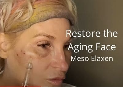 Restore the Aging Face – Meso Elaxen PDRN | Acecosm.com | #facelift #DIY