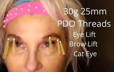 30g 25mm PDO Threads | Eye Lift | Brow Lift | Uplift to the Entire Orbital Area | Cat Eye