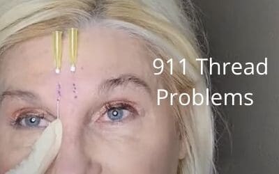 911 Thread Problems |What to do