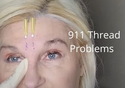 911 Thread Problems |What to do