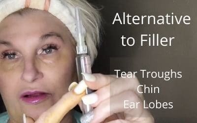 Alternative to Filler | Tear Troughs, Chin, and Rejuvenation of Ear Lobes | Safe and Easy