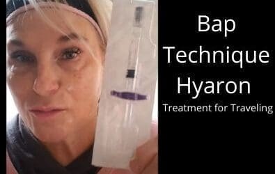 Bap Technique Hyaron | Treatment for Traveling