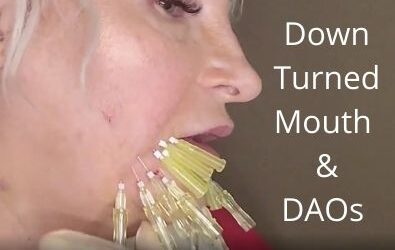Down Turned Mouth | DAOs | Very Quick Thread Pattern