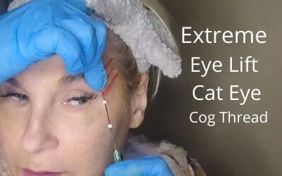Extreme Eye Lift | Cat Eye | Cog Thread