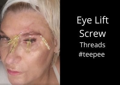 Eye Lift | Screw threads for the lift | #teepee eye lift