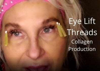 Eye Lift | Threads | Collagen Production