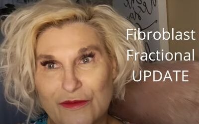 Fibroblast & Fractional Update | Unsettled Threads | Let’s Get Ready for Fall