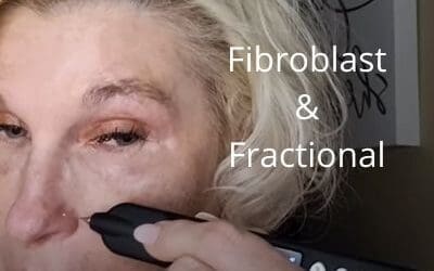 Fibroblast Nasal Area – Nose | Fractional Entire Face | Get Glowing Now Skin Care