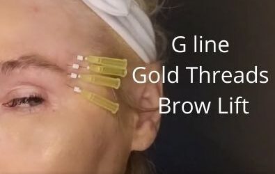 G line gold threads |99.99% longevity |  Brow Lift Aging Eye | Acecosm.com