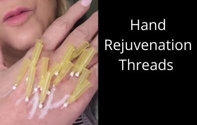 Hand Rejuvenation | Threads |How to Look Young Again.