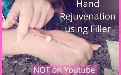 Hand Rejuvenation using Filler (Tesoro) | Video NOT on Youtube