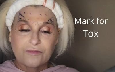 How I mark for Tox | Easy to understand | 11s, Crows Feet, Brow Lift
