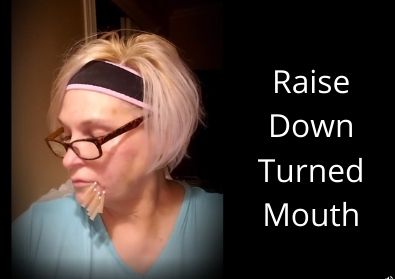 How to Raise your Down Turned Mouth | Threads for the Lift