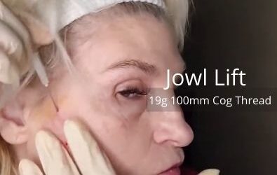 Jowl Lift | 19g 100mm Cog Thread