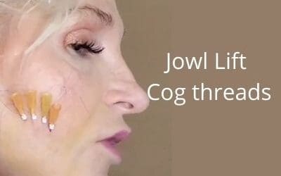 Jowl Lift | Cog threads