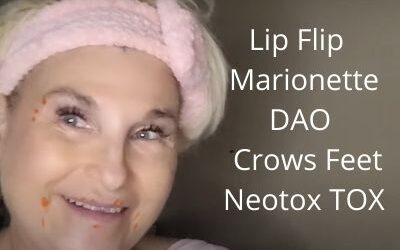 Lip Flip | Marionette | DAO | Crows Feet | Neotox TOX