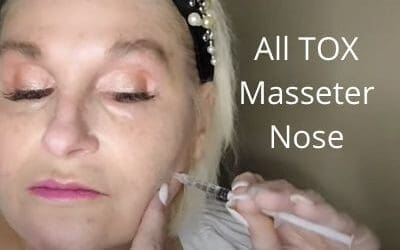 Masseter Slim Face | Tox for the Nose | Fresher Younger Look | All  TOX