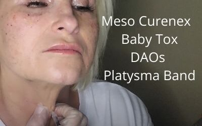 Meso Curenex | Baby tox  |DAOs | Platysma Band
