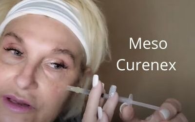 Meso Curenex and a little Chat