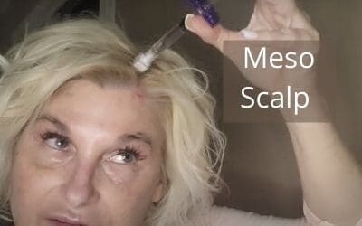 Meso your Hair Scalp with Hyaron, Stem Cells  | Treatments for All Ages and Hair Type