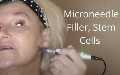 Microneedle | Filler, Stem Cells | Martini for the Face
