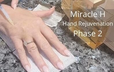 Miracle H | Phase 2 | Hand Rejuvenation