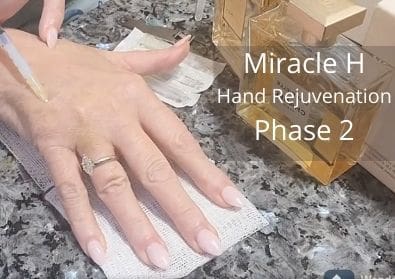 Miracle H | Phase 2 | Hand Rejuvenation