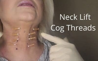 Neck Lift Cog threads | Amazing Results