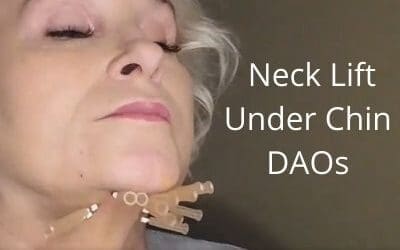 Neck Lift | Threads | Under Chin |Neck |DAOs | Aging Neck Lift