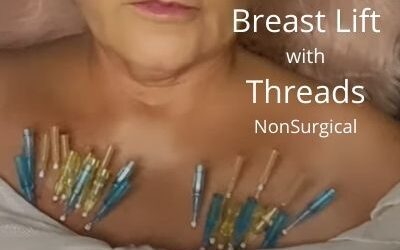 Non Surgical Breast Lift with Threads – Phase 1 | Acecosm.com