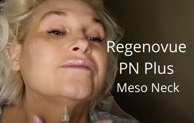 Regenovue PN Plus | Meso Neck and Jawline