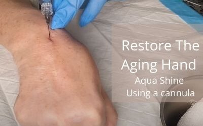 Restore The Aging Hand | Aqua Shine | Using a cannula