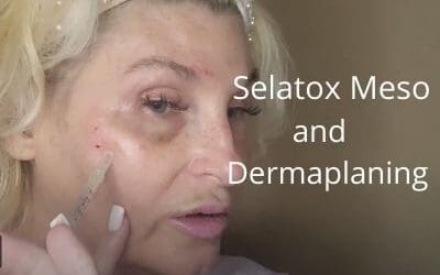 Selatox Meso | Mesotherapy | Dermaplaning
