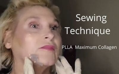 Sewing Technique |  PLLA – Maximum Collagen Threads | First to DIY