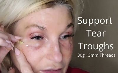 Support Tear Troughs | 30g 13mm Threads