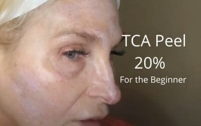 TCA Peel 20% | Details for the Beginner