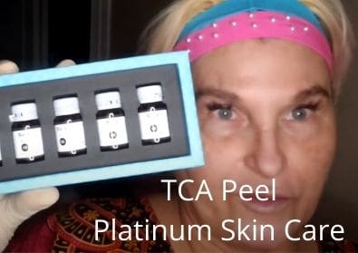 TCA Peel | Platinum Skin Care