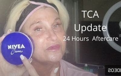 TCA Update – 24 Hours | Aftercare | Beginner Peel |