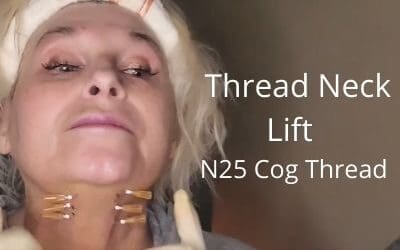 Thread Neck Lift | N25 Cog Thread | My Favorite Cog Thread