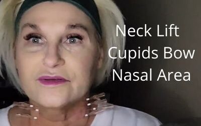 Turkey Neck Lift | Cupids Bow | Threads 38mm  into the Nasal Area