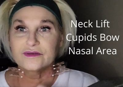 Turkey Neck Lift | Cupids Bow | Threads 38mm  into the Nasal Area