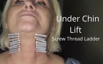 Under Chin Lift | Screw Thread Ladder | To Address Sagging Skin